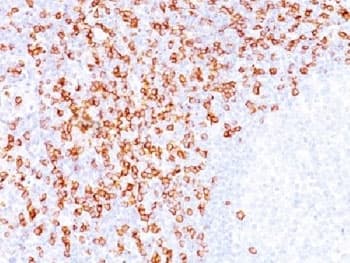 CD8A / CD8 Alpha Antibody (C-Terminus, clone C8/144B, Ready-to-Use)