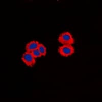 Polyclonal Rabbit anti-Human PPP1R14A / CPI-17 Antibody (N-Terminus, IHC, IF, WB)