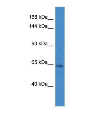 JHDM1A / KDM2A Antibody (aa1023-1072)