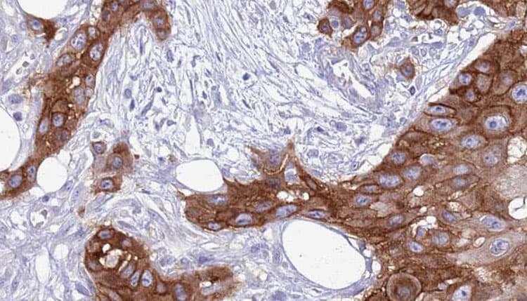 DAP12 Antibody