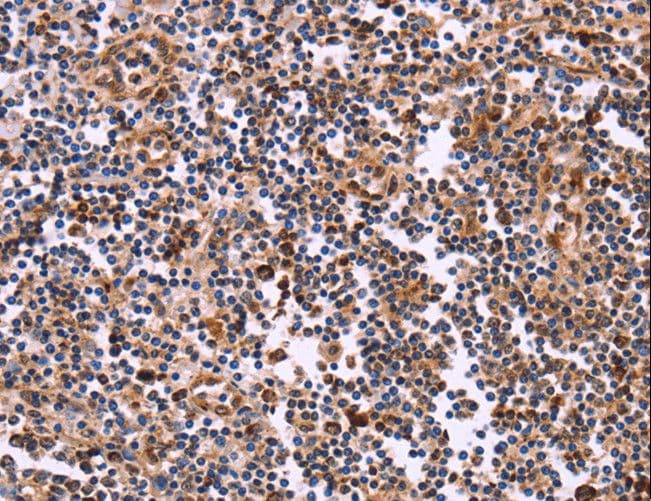 CLUAP1 Antibody