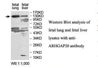ARHGAP20 Antibody (aa526-729)