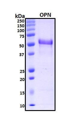 Human SPP1 / Osteopontin Protein (Recombinant His, N-Terminal)