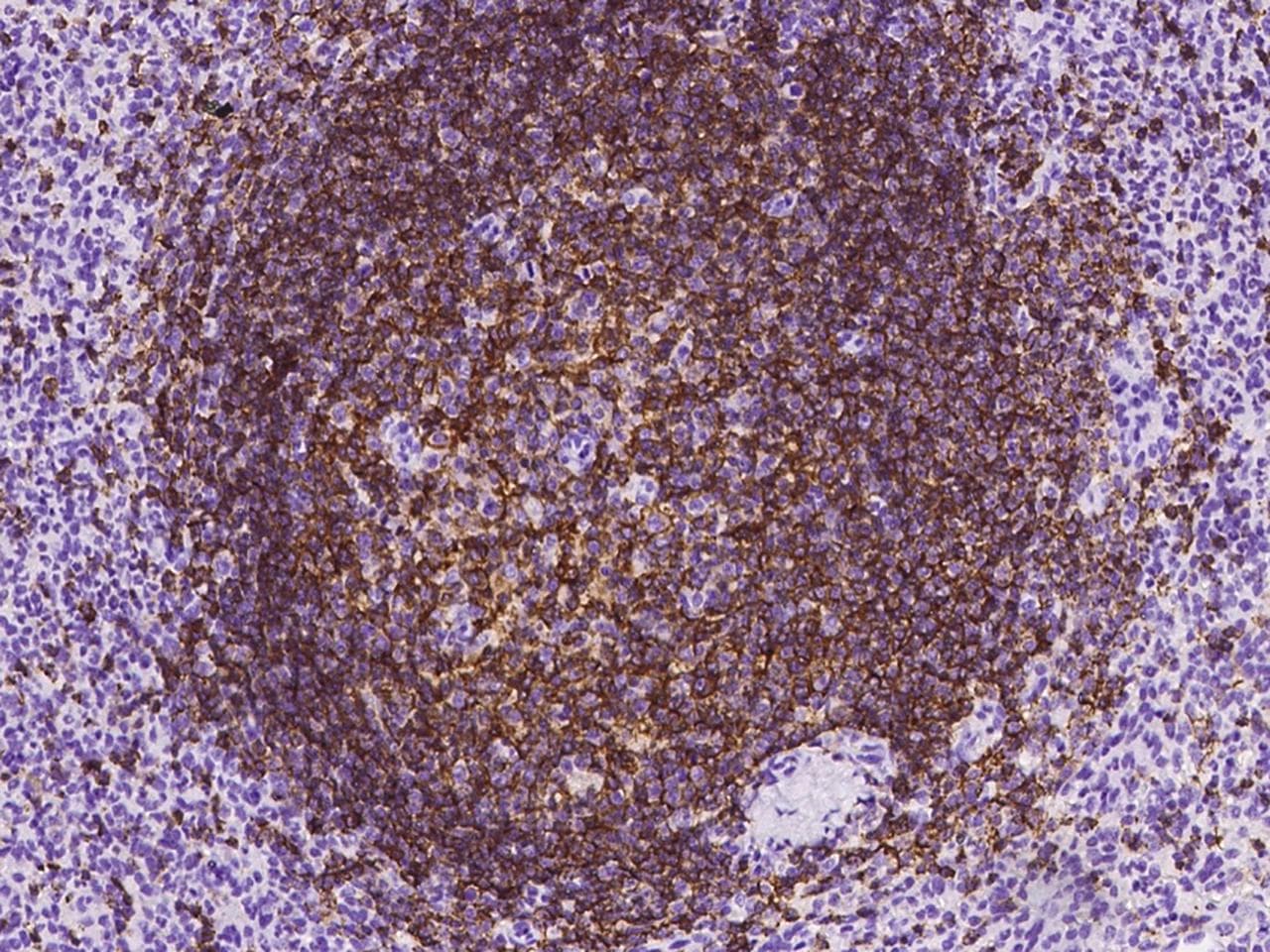 Monoclonal Mouse anti-Human CD20 Antibody (clone 06, Preservative Free, IHC)