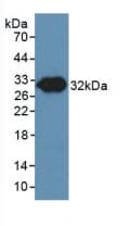 NOS3 / eNOS Antibody (aa758-1004, PE)