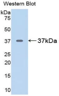 ARG1 / Arginase 1 Antibody (aa1-323, PE)