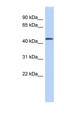 Polyclonal Rabbit anti-Human SMAD2 Antibody (N-Terminus, WB)