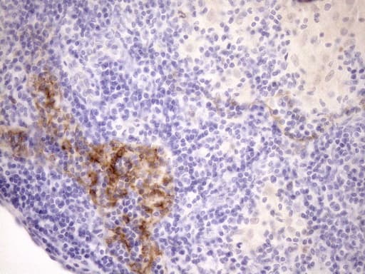 p16INK4a / CDKN2A Antibody (clone OTI1H3)