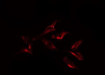 Polyclonal Rabbit anti-Human KNG1 / Kininogen / Bradykinin Antibody (IHC, IF, WB)