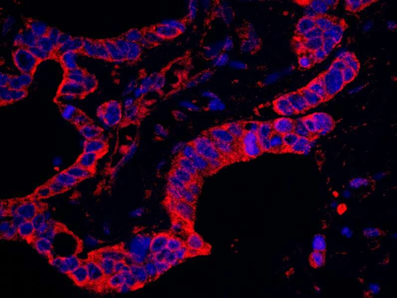 DAP-5 / EIF4G2 Antibody (aa125-175)