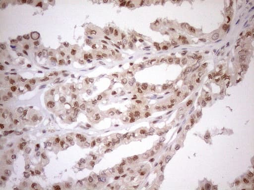 Monoclonal Mouse anti-Human MGMT Antibody (clone OTI2F10, Carrier-free, IHC, WB)