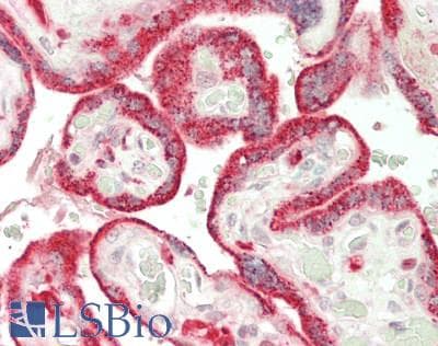 IHC-plus™ Polyclonal Rabbit anti-Human P450SCC / CYP11A1 Antibody (aa40-521, IHC, WB)
