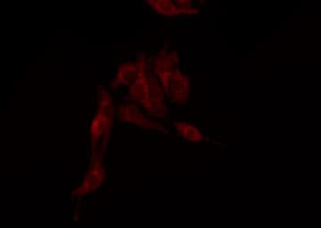 Polyclonal Rabbit anti-Human NFKBIE / IKB Epsilon Antibody (IHC, IF, WB)