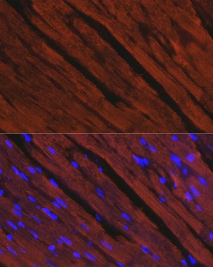 MYHC / MYH6 Antibody