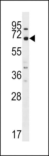 Polyclonal Rabbit anti-Human MEGF9 / EGFL5 Antibody (aa521-549, IHC, WB)