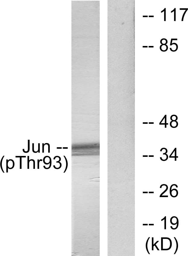JUN / c-Jun Antibody (phospho-Thr93)