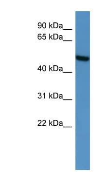 Polyclonal Rabbit anti-Human CERKL Antibody (aa381-430, WB)