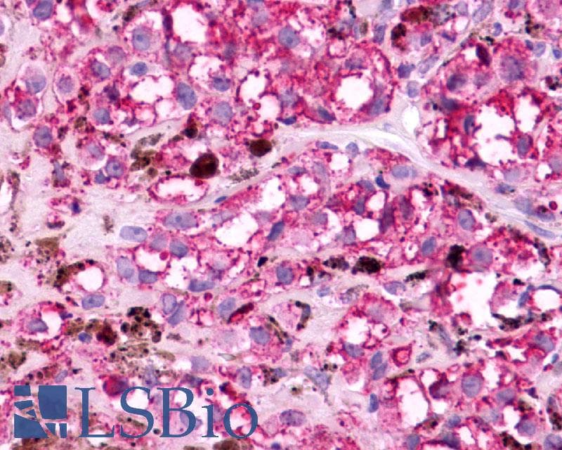 IHC-plus™ Polyclonal Rabbit anti-Human MC5R / MC5 Receptor Antibody (N-Terminus, IHC)
