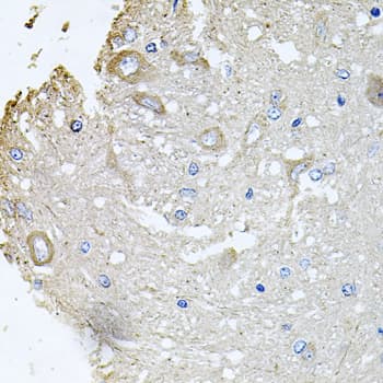Polyclonal Rabbit anti-Human CHCHD3 Antibody (IHC, WB)