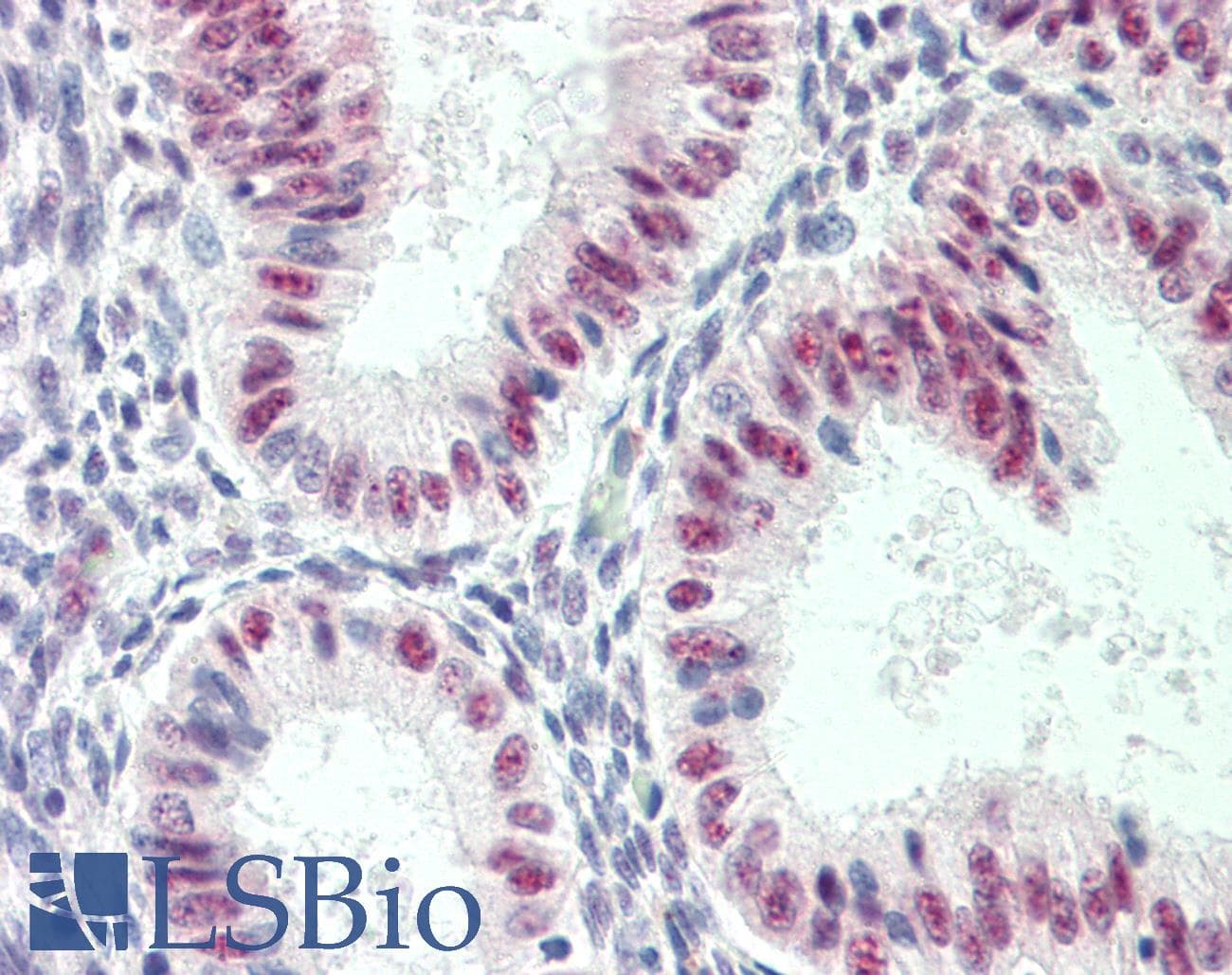 IHC-plus™ MKNK1 / MNK1 Antibody (aa216-265)