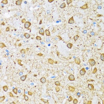Polyclonal Rabbit anti-Human NOL3 / ARC Antibody (IHC, IF, WB)