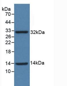 INSR / Insulin Receptor Antibody (aa1024-1298, FITC)