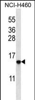 Polyclonal Rabbit anti-Human HIST1H2BO Antibody (aa 1-30, N-term, WB)