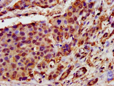 Polyclonal Rabbit anti-Human GHITM Antibody (IHC, WB)