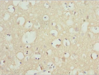 Polyclonal Rabbit anti-Human NINL Antibody (IHC)