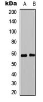 ESR2 / ER Beta Antibody (phospho-Ser105)
