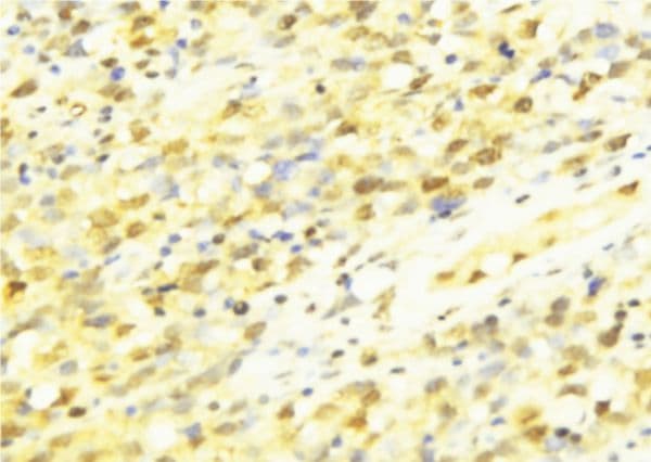APITD1 Antibody