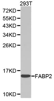 IHC-plus™ Polyclonal Rabbit anti-Human I-FABP / FABP2 Antibody (IHC, IF, WB)