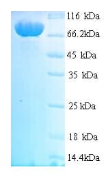 Human MASP1 / MASP Protein (Recombinant 6His, N-terminus)
