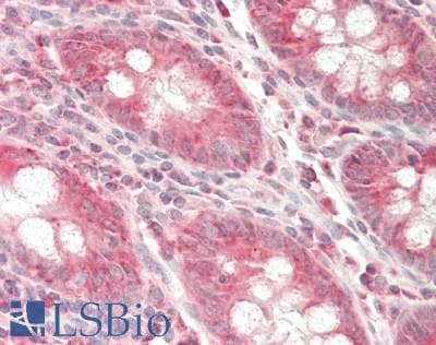 IHC-plus™ B4GALT3 Antibody (aa34-393)