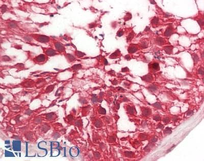 RHBDD1 Antibody (C-Terminus)