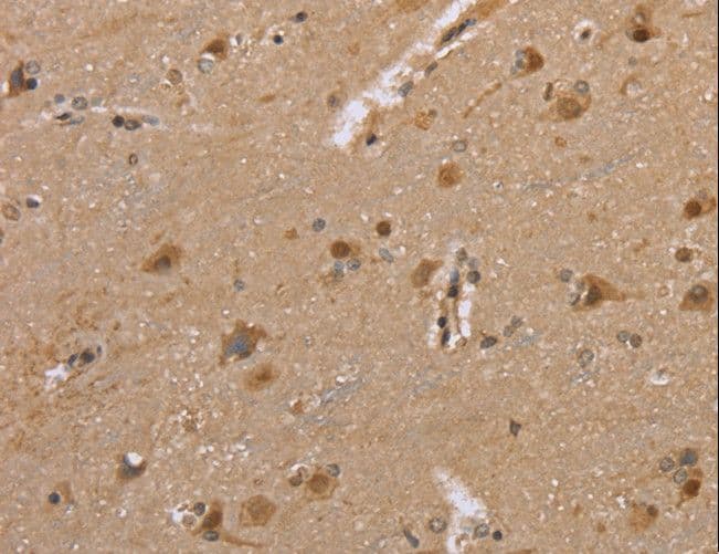 Polyclonal Rabbit anti-Human DLD / Diaphorase / E3 Antibody (IHC)