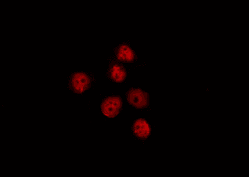 Polyclonal Rabbit anti-Human OSR2 Antibody (IF, WB)