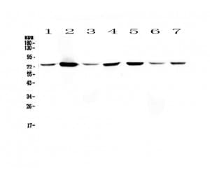 Polyclonal Rabbit anti-Human ANXA6/Annexin A6/Annexin VI Antibody (IHC, WB)