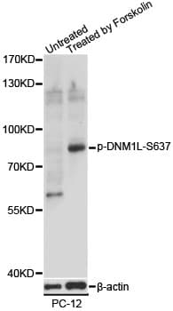 DNM1L / DRP1 Antibody (phospho-Ser637)