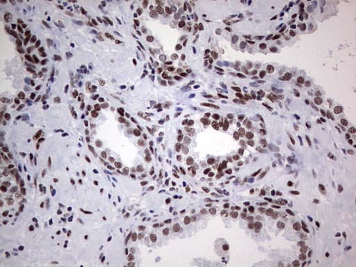 HDAC9 Antibody (aa181-460, clone OTI7G2, Carrier-free)