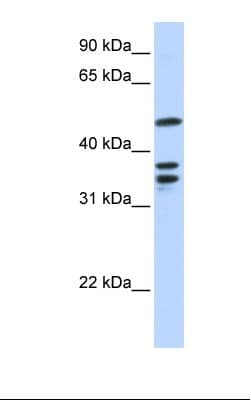 ETV6 / TEL Antibody (aa72-121)