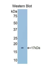 CUBN / Cubilin Antibody (aa3157-3274)