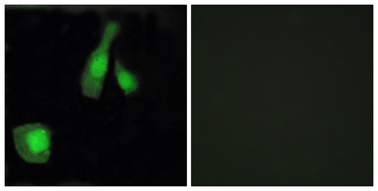 PPP1R14A / CPI-17 Antibody (p38)