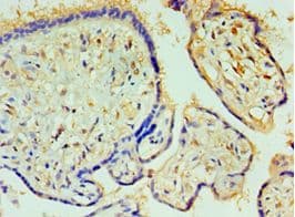 Polyclonal Rabbit anti-Human CPA1 / Carboxypeptidase A Antibody (aa111-419, IHC)