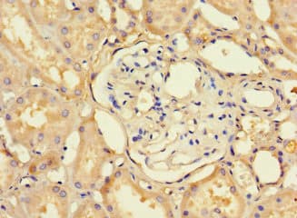 Polyclonal Rabbit anti-Human C12orf65 Antibody (IHC)