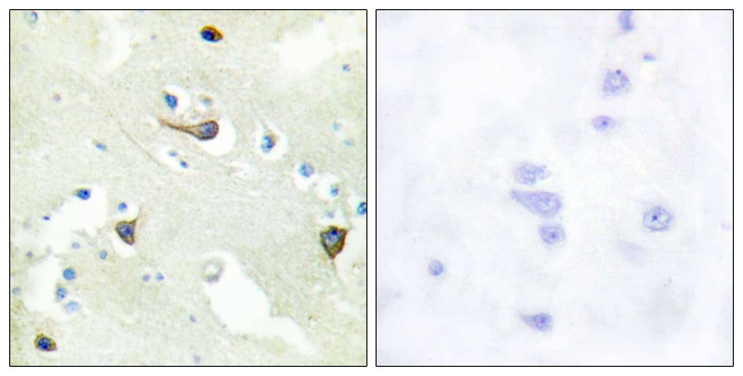 EPH Receptor B1+B2+B3 Antibody (Internal)