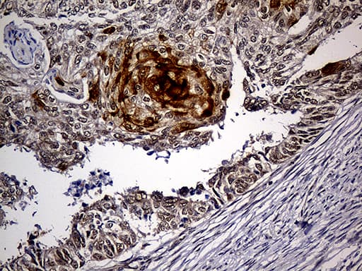 PPP2R1B Antibody (aa19-601, clone OTI8B6)