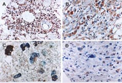 CASP6 / Caspase 6 Antibody