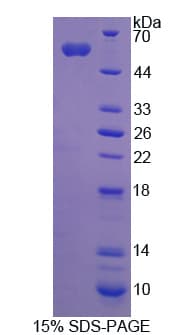 Human ADNP Protein (Recombinant His-GST)