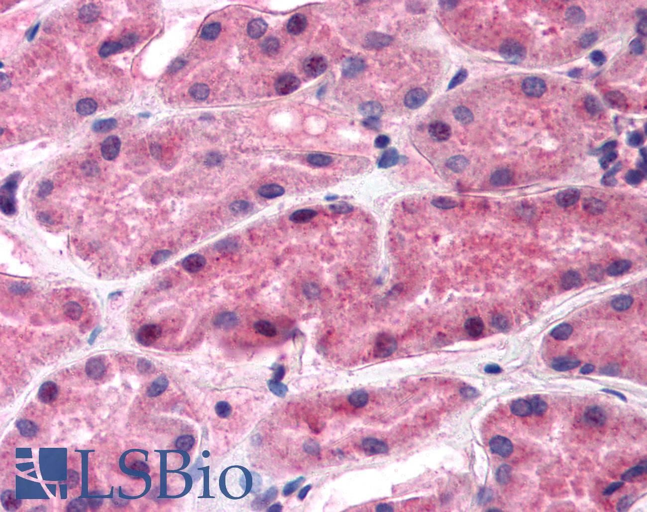REN / Renin 1 Antibody